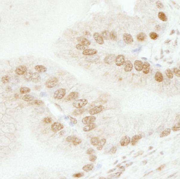 Anti-SMARCB1/SNF5 (IHC)