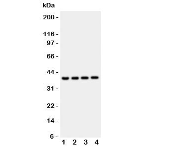 Anti-Cathepsin D