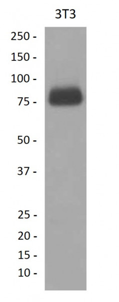 Anti-CD36