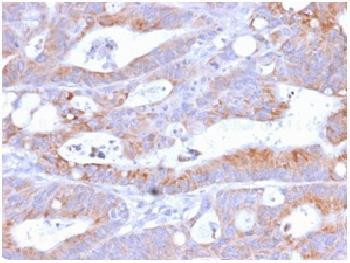 Anti-CD86 (Dendritic Cells Maturation Marker) Recombinant Rabbit Monoclonal Antibody (clone:C86/2160