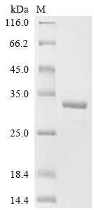 Eukaryotic translation initiation factor 5B (EIF5B), partial, human, recombinant