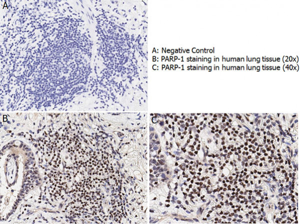 PARP1 (N-term ZF1) Antibody Set