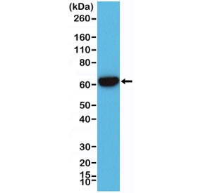 Anti-Cytokeratin 5/6 (recombinant antibody), clone RM341