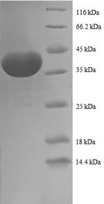 Prefoldin subunit 1 (PFDN1), human, recombinant