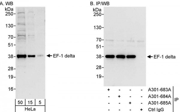 Anti-EF-1 delta