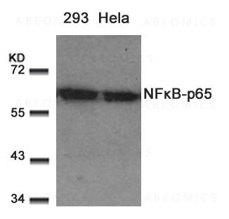 Anti-NFkB-p65 (Ab-529)