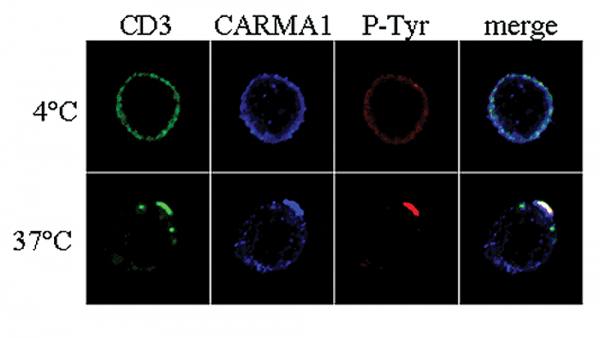 Anti-CARMA1 (AL220)