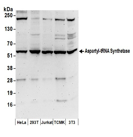 Anti-Aspartyl-tRNA Synthetase/DARS