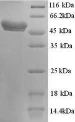 N-acetylgalactosamine-6-sulfatase (GALNS), human, recombinant