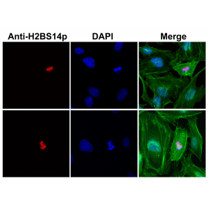 Anti-Phospho-Histone H2B (Ser14), Rabbit Monoclonal (RM238)