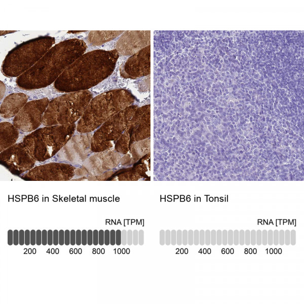 Anti-HSPB6