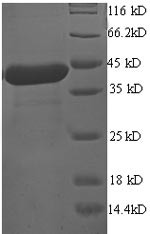 Programmed cell death protein 6 (PDCD6), human, recombinant