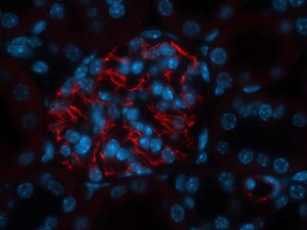 Anti-Bestrophin 3