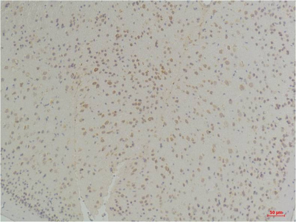 Anti-Connexin-26