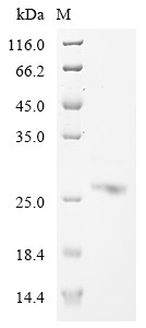 Interferon-activable protein 204 (Ifi204), partial, mouse, recombinant