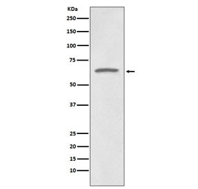 Anti-p73 / Tumor Protein 73, clone EHI-20