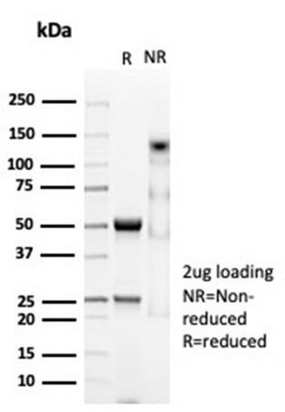 Anti-CD74 (B-Cell Marker), recombinant antibody, clone CLIP/7023R
