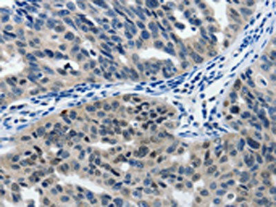 Anti-MATN1