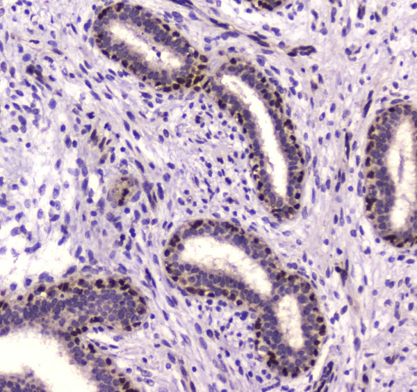 Anti-NFIB / NF1B2