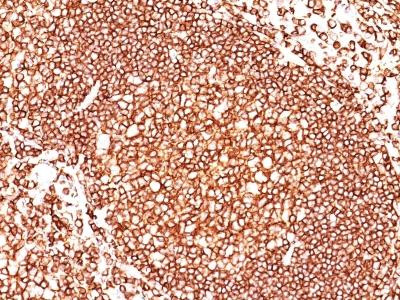Anti-CD45 / LCA (Leucocyte Marker)(Clone: 136-4B5)