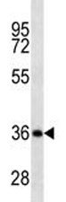 Anti-CD20, clone 407CT20.1.2