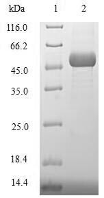 DNA repair protein XRCC3 (XRCC3), human, recombinant
