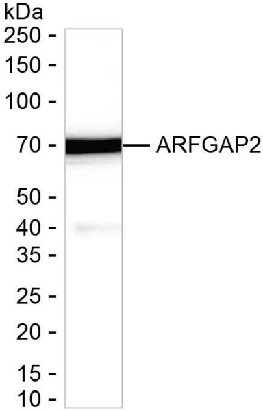 Anti-ARFGAP2