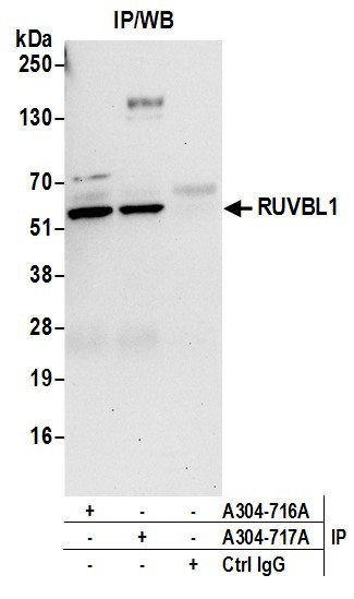 Anti-RUVBL1