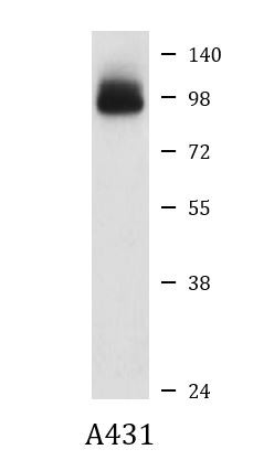 Anti-Glucocorticoid Receptor