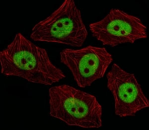 Anti-XRCC1