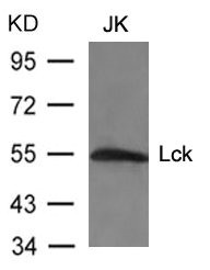 Anti-LCK (Ab-394)