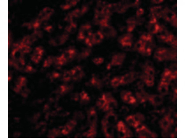 Anti-ApoA1