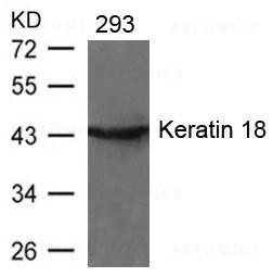 Anti-Keratin 18 (Ab-33)