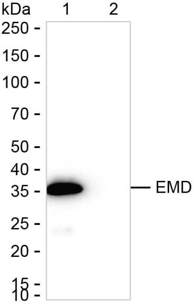 Anti-EMD