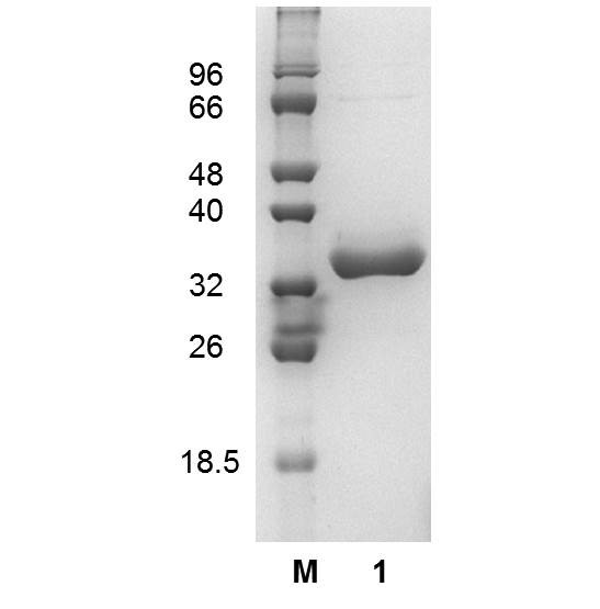 Glutaminase (EC 3.5.1.2), Escherichia coli