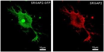 Anti-SRGAP2