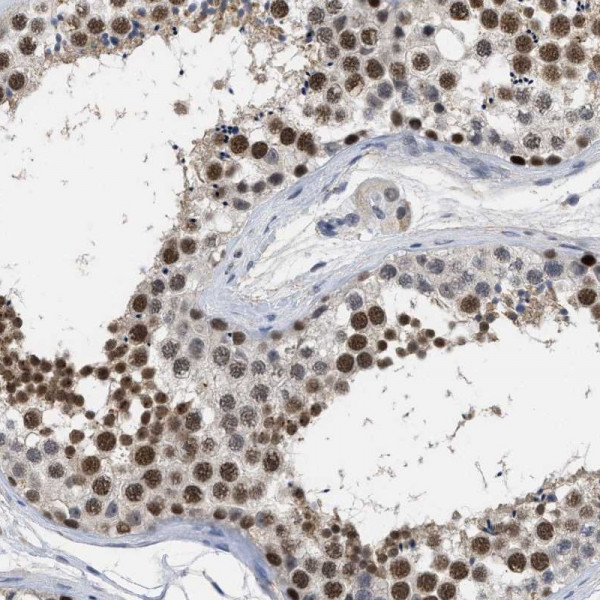 Anti-GGNBP2