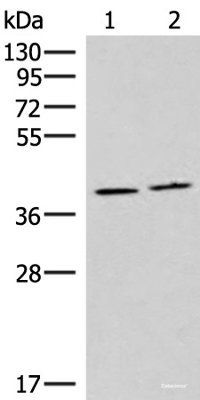 Anti-HMGCLL1