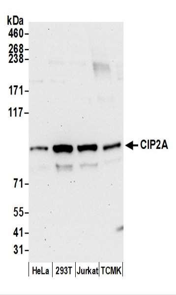 Anti-CIP2A Monoclonal