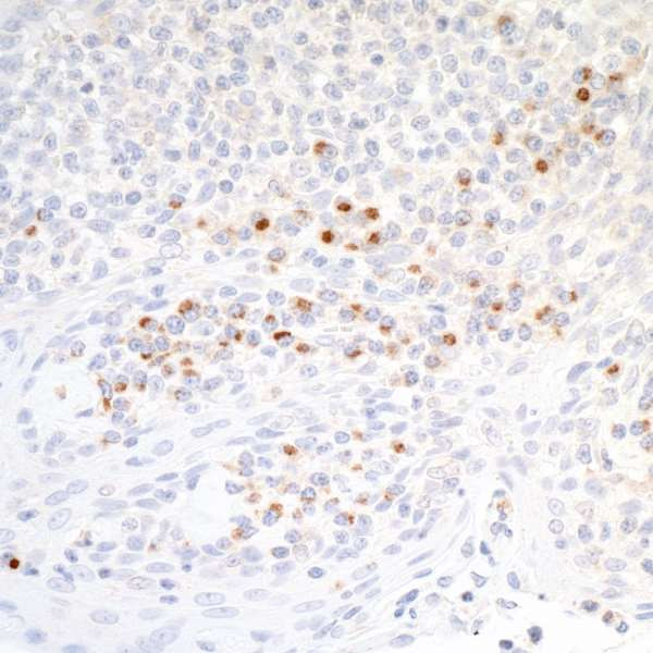 Anti-CD86 Recombinant Monoclonal