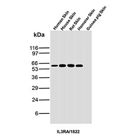 Anti-IL3RA / Interleukin-3 receptor subunit alpha, clone IL3RA/1822