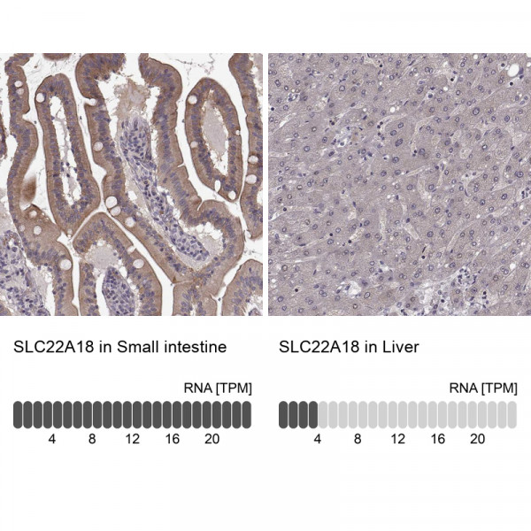 Anti-SLC22A18