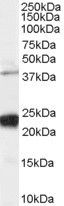 Anti-GIPC1 / NIP, C-terminal