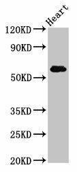 Anti-SLC11A1