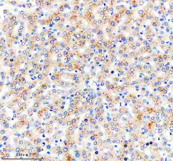 Anti-NSUN6 / NOP2/Sun RNA methyltransferase family member 6