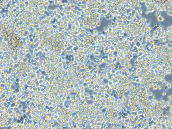 HROC87 T0 M2 Cells
