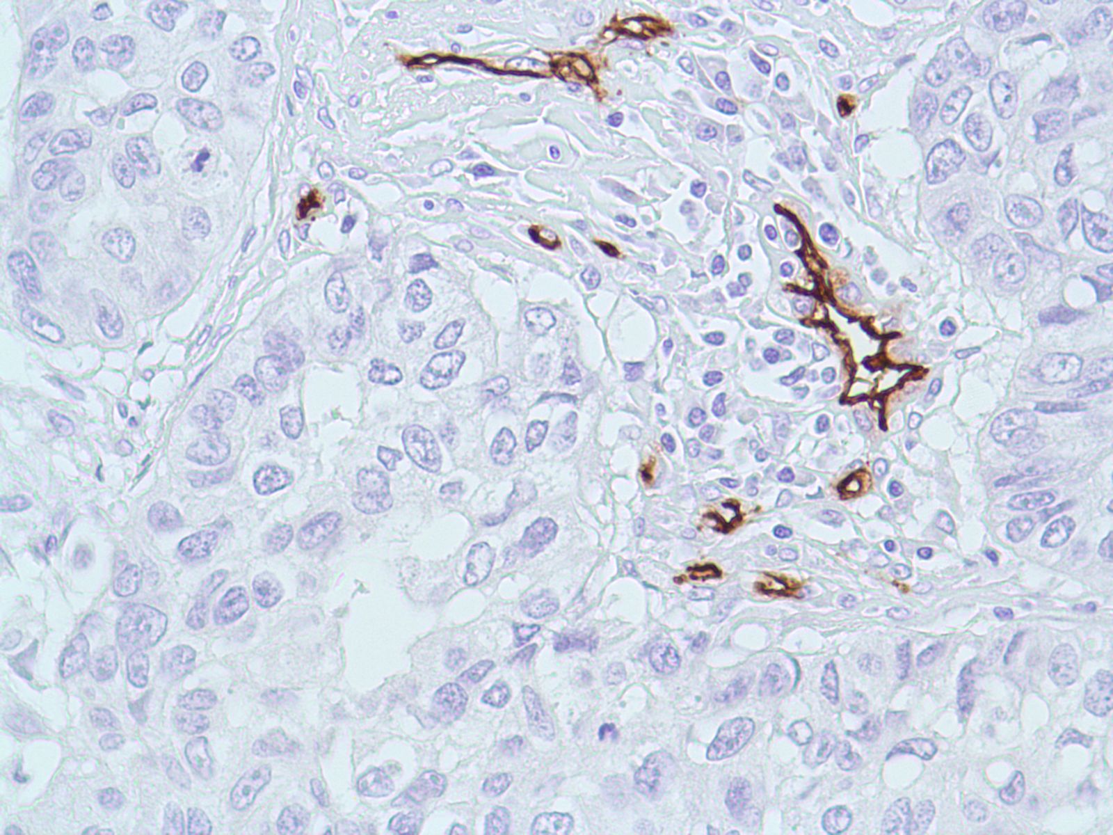 Иммуногистохимия эндометрия. Cd34 иммуногистохимия. CD 34 маркер. Cd34 Cell. CD 34 маркер ИГХ.