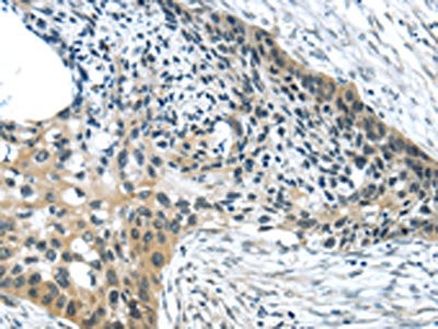 Anti-HCN4
