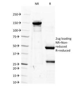 Anti-IGF1, clone M23