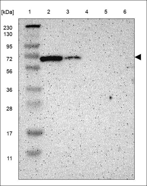 Anti-ERVMER34-1